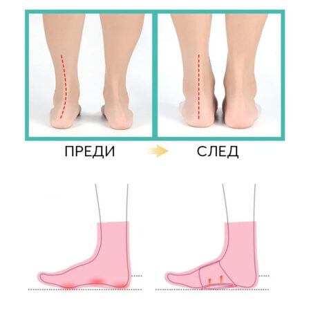 Kecovebg.com© | Комфортни решения за вашите ходила 86 0011